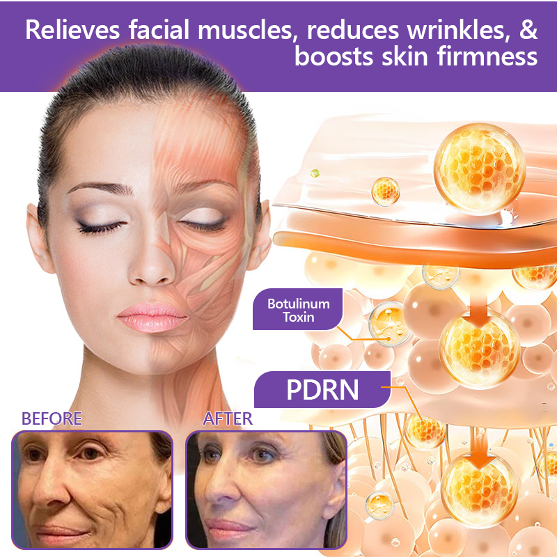 𝐋𝐮𝐦𝐨𝐫𝐢𝐞® PDRN🦘 Multi-Peptide Massaging Body Roller Cream- Anti-aging, Hydrating, Skin Firming & Lifting, Skin Repair, Even Tone, Acne and Dark Spot Treatment, Wart and Mole Removal, and Psoriasis Relief.