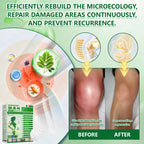 𝙋𝙧𝙤𝙥𝙚𝙧 𝑴𝒆𝒅𝒊𝒄𝒂𝒍-𝑮𝒓𝒂𝒅𝒆 & 𝐒𝐩𝐞𝐜𝐢𝐚𝐥𝐢𝐬𝐭-𝐕𝐞𝐭𝐭𝐞𝐝👩‍⚕️ | 𝙈𝑼𝐑𝒲𝓞𝙽® 𝑴-𝑩 -𝙉 𝟭𝟬-𝙞𝓷-𝟏 𝙉𝙖𝙣𝒐 𝑭𝓾𝙨𝙞𝙤𝙣 𝙈𝓮𝓽𝙖𝙗𝙤𝒍𝒊𝓬 𝑷𝒂𝒕𝓬𝙝🥥𝐒𝐜𝐢𝐞𝐧𝐭𝐢𝐟𝐢𝐜𝐚𝐥𝐥𝐲 𝐀𝐩𝐩𝐫𝐨𝐯𝐞𝐝 | 10-𝐢𝐧-𝟏 𝐅𝐨𝐫𝐦𝐮𝐥𝐚 | 𝐑𝐞𝐬𝐮𝐥𝐭𝐬 𝐢𝐧 𝐉𝐮𝐬𝐭 7 𝐃𝐚𝐲𝐬🥦