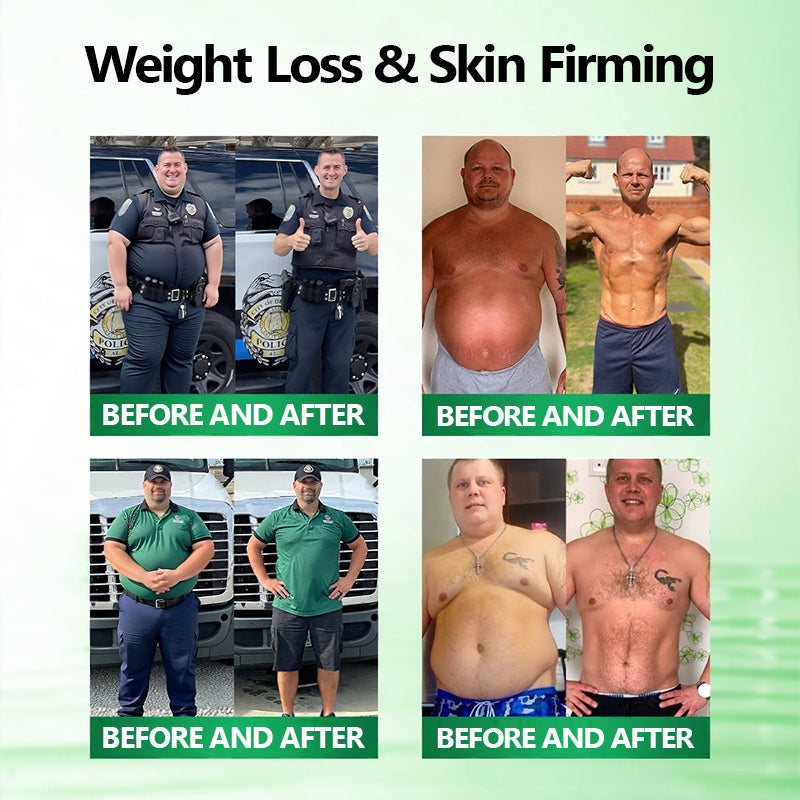 𝙋𝙧𝙤𝙥𝙚𝙧 𝑴𝒆𝒅𝒊𝒄𝒂𝒍-𝑮𝒓𝒂𝒅𝒆 & 𝐒𝐩𝐞𝐜𝐢𝐚𝐥𝐢𝐬𝐭-𝐕𝐞𝐭𝐭𝐞𝐝👩‍⚕️ | 𝙈𝑼𝐑𝒲𝓞𝙽® 𝑴-𝑩 -𝙉 𝟭𝟬-𝙞𝓷-𝟏 𝙉𝙖𝙣𝒐 𝑭𝓾𝙨𝙞𝙤𝙣 𝙈𝓮𝓽𝙖𝙗𝙤𝒍𝒊𝓬 𝑷𝒂𝒕𝓬𝙝🥥𝐒𝐜𝐢𝐞𝐧𝐭𝐢𝐟𝐢𝐜𝐚𝐥𝐥𝐲 𝐀𝐩𝐩𝐫𝐨𝐯𝐞𝐝 | 10-𝐢𝐧-𝟏 𝐅𝐨𝐫𝐦𝐮𝐥𝐚 | 𝐑𝐞𝐬𝐮𝐥𝐭𝐬 𝐢𝐧 𝐉𝐮𝐬𝐭 7 𝐃𝐚𝐲𝐬🥦