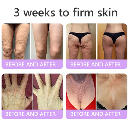 𝐋𝐮𝐦𝐨𝐫𝐢𝐞® PDRN🦘 Multi-Peptide Massaging Body Roller Cream- Anti-aging, Hydrating, Skin Firming & Lifting, Skin Repair, Even Tone, Acne and Dark Spot Treatment, Wart and Mole Removal, and Psoriasis Relief.