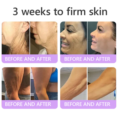 𝐋𝐮𝐦𝐨𝐫𝐢𝐞® PDRN🦘 Multi-Peptide Massaging Body Roller Cream- Anti-aging, Hydrating, Skin Firming & Lifting, Skin Repair, Even Tone, Acne and Dark Spot Treatment, Wart and Mole Removal, and Psoriasis Relief.