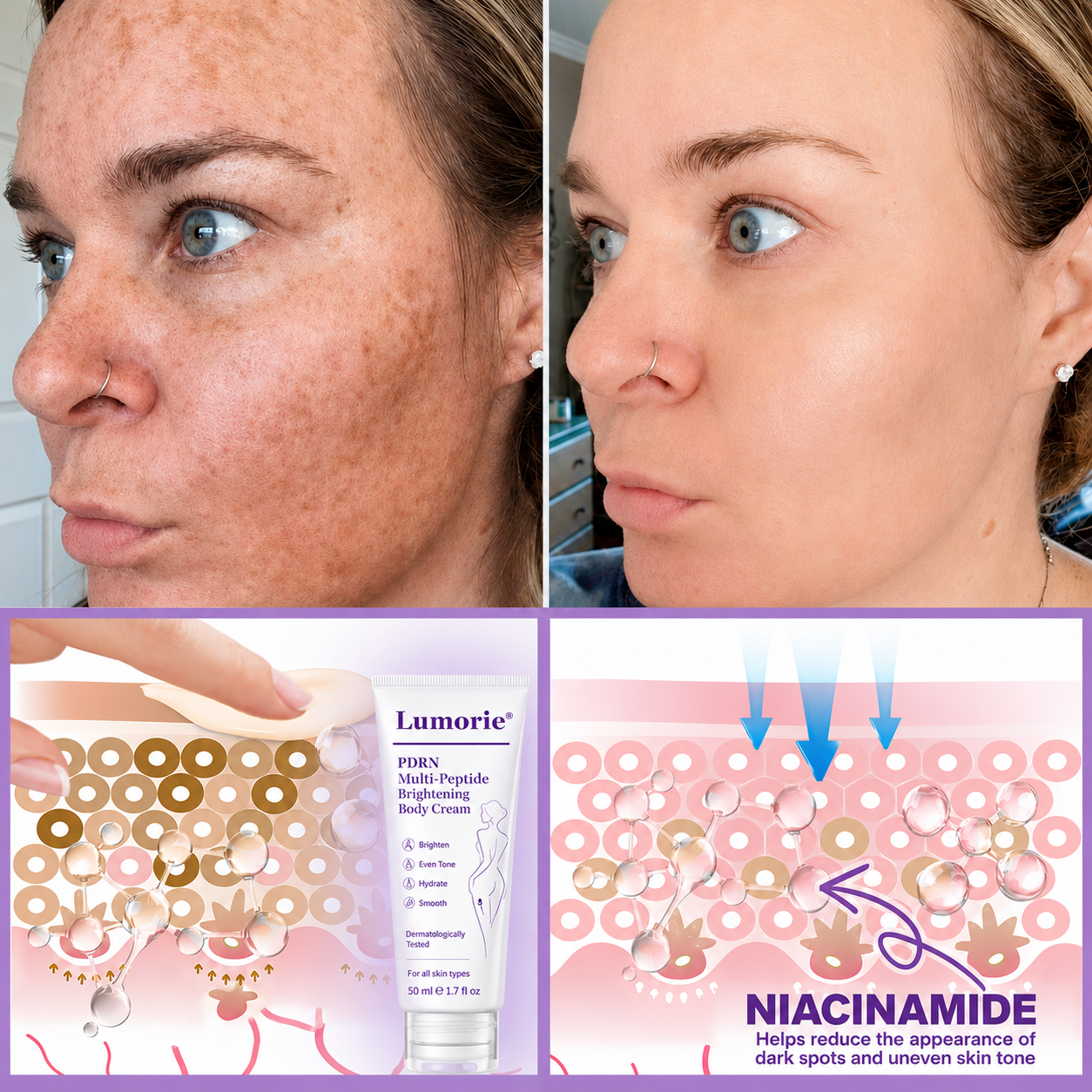𝐋𝐮𝐦𝐨𝐫𝐢𝐞® PDRN🦘 Multi-Peptide Massaging Body Roller Cream- Anti-aging, Hydrating, Skin Firming & Lifting, Skin Repair, Even Tone, Acne and Dark Spot Treatment, Wart and Mole Removal, and Psoriasis Relief.