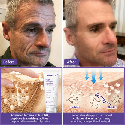 𝐋𝐮𝐦𝐨𝐫𝐢𝐞® PDRN🦘 Multi-Peptide Massaging Body Roller Cream- Anti-aging, Hydrating, Skin Firming & Lifting, Skin Repair, Even Tone, Acne and Dark Spot Treatment, Wart and Mole Removal, and Psoriasis Relief.